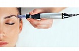 Benefits of Microneedling for Your Skin