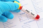 5 Myths About Prostate Cancer—Debunked